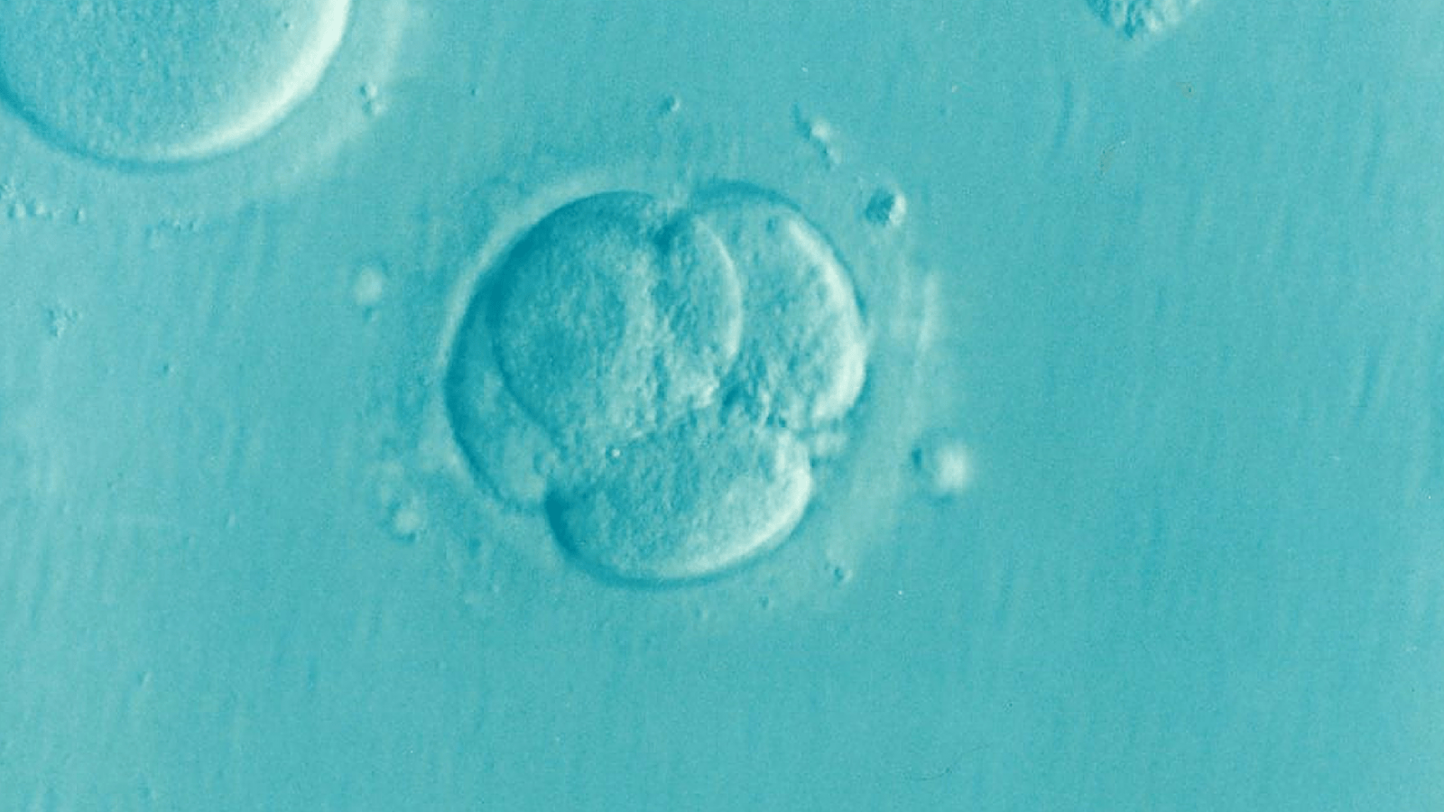 ivf